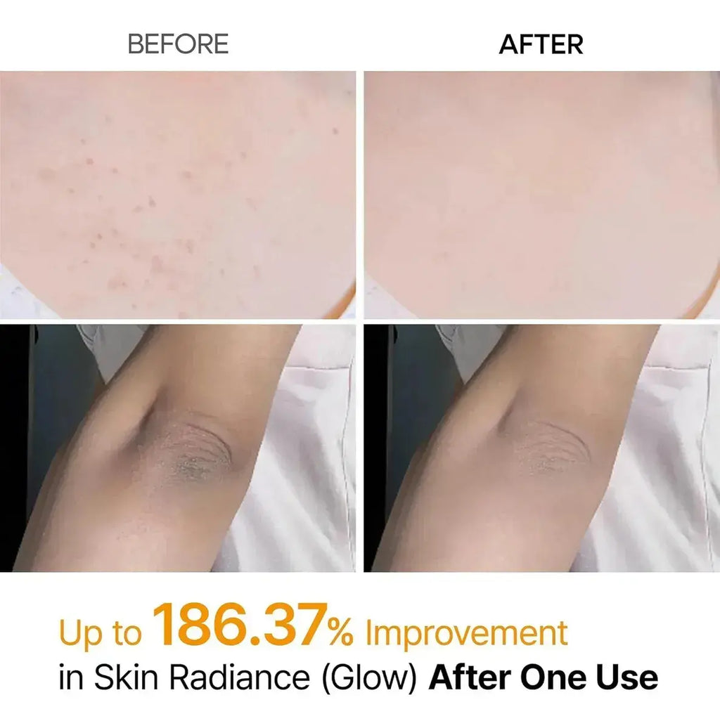 Dr. Melaxin Peel Shot: Peeling Coreano Glass Skin