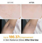 Dr. Melaxin Peel Shot: Peeling Coreano Glass Skin