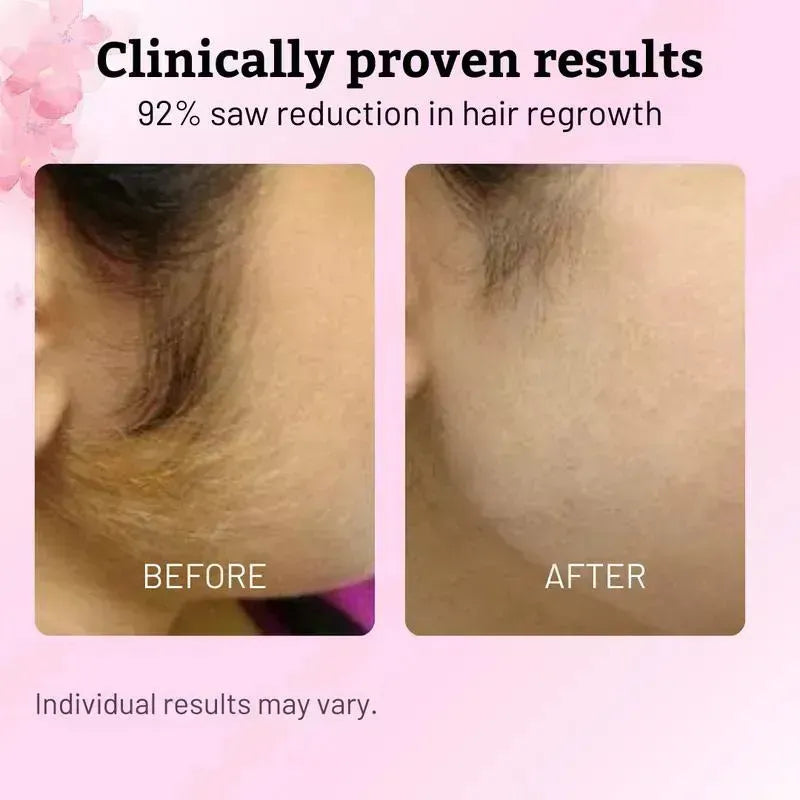 Cyperus Rotundus Hair Reduction Oil: Menos Vello, Menos Depilación