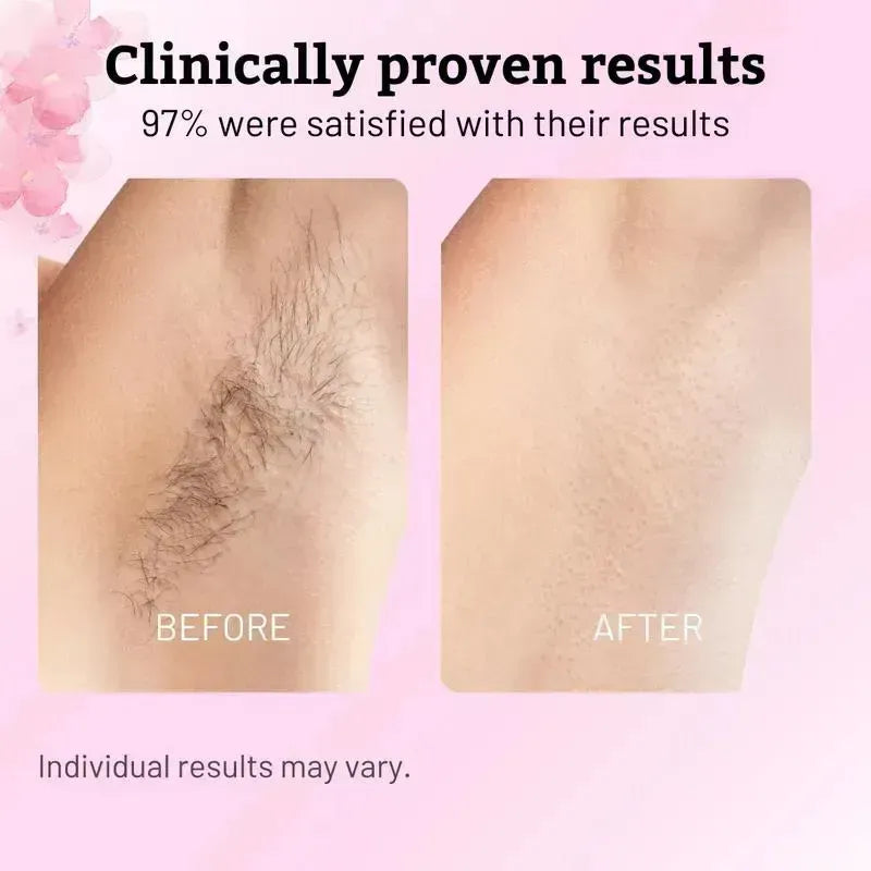 Cyperus Rotundus Hair Reduction Oil: Menos Vello, Menos Depilación