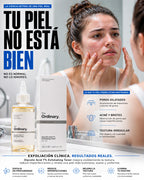 The Ordinary Ácido Glicólico 7%: Glow profesional en casa